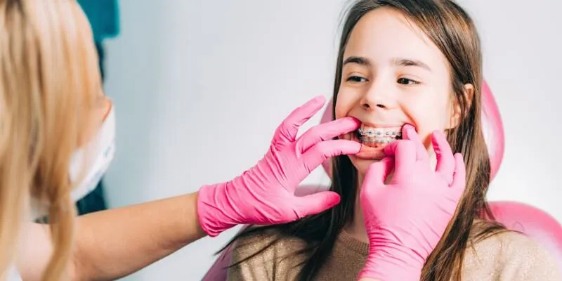 Niềng răng cho trẻ em